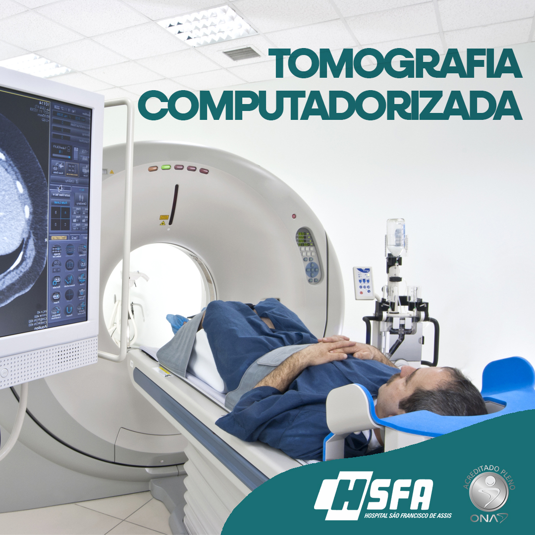 Tomografia Computadorizada